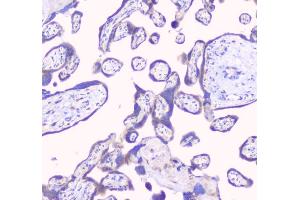 IHC analysis of RPS3 using anti-RPS3 antibody (ABIN6719371).