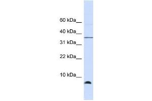 HSPE1 antibody used at 1 ug/ml to detect target protein. (HSPE1 抗体)