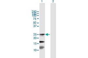 Western Blot analysis of FXN expression in transfected 293T cell line by FXN MaxPab polyclonal antibody. (Frataxin 抗体  (AA 1-210))