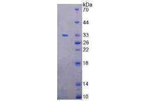 SDS-PAGE analysis of Human Uromodulin Protein. (Uromodulin Protein (UMOD))