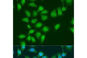Immunofluorescence analysis of U2OS cells using EYA3 Polyclonal Antibody at dilution of 1:100. (EYA3 抗体)
