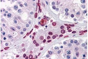 Immunohistochemistry (Formalin-fixed Paraffin-embedded Sections) (IHC (fp)) image for anti-WD Repeat Domain 20 (WDR20) (AA 1-570) antibody (ABIN574467)