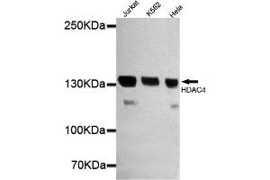 Western blot detection of HDAC4 in Jurkat,Hela and K562 cell lysates using HDAC4 mouse mAb (1:1000 diluted). (HDAC4 抗体  (N-Term))