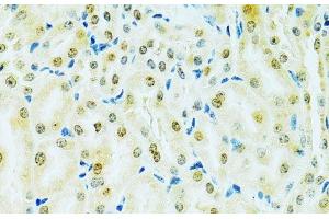 Immunohistochemistry of paraffin-embedded Mouse kidney using RCC1 Polyclonal Antibody at dilution of 1:100 (40x lens). (RCC1 抗体)