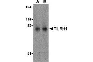 Western Blotting (WB) image for anti-Toll-Like Receptor 11 (Tlr11) (C-Term) antibody (ABIN1030741) (TLR11 抗体  (C-Term))