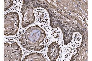 IHC analysis of CoREST/RCOR1 using anti-CoREST/RCOR1 antibody (ABIN7601035).