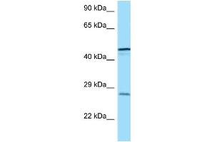 WB Suggested Anti-TREM1 Antibody Titration: 1. (TREM1 抗体  (C-Term))