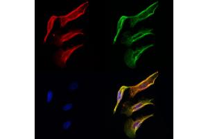 ABIN6261648 and ABIN6276771 staining Hela cells by IF/ICC. (FABP2 抗体  (C-Term))