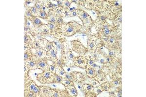 Immunohistochemistry of paraffin-embedded human liver injury using GLUD2 antibody.