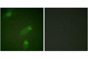 Immunofluorescence analysis of HeLa cells, using NF-kappaB p105/p50 (Ab-927) Antibody. (NFKB1 抗体  (AA 896-945))