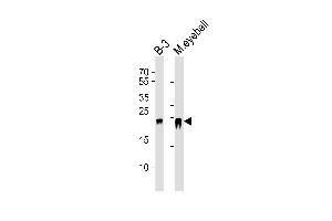 Western blot analysis of lysates from B-3 cell line and mouse eyeball tissue lysate(from left to right), using CRYBB2 Antibody (N-term) (ABIN6243390 and ABIN6577568). (CRYbB2 抗体  (N-Term))
