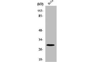 Western Blot analysis of COLO205 cells using Ribosomal Protein S4X Polyclonal Antibody (RPS4X 抗体  (Internal Region))