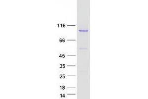 Western Blotting (WB) image for BCL2-Like 13 (Apoptosis Facilitator) (BCL2L13) protein (Myc-DYKDDDDK Tag) (ABIN2715195)