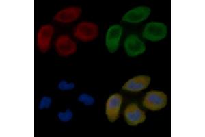 ABIN6265371 and ABIN6277613 staining Hela cells(30 min of UV treatment) by IF/ICC.