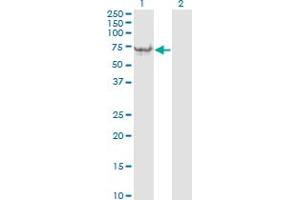 Western Blotting (WB) image for anti-Vimentin (VIM) (AA 41-140) antibody (ABIN563373)