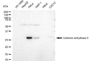 Western blotting analysis using Carbonic anhydrase II antibody (ABIN7797868).