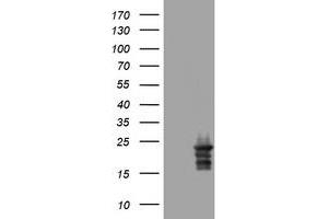Image no. 3 for anti-Visinin-Like 1 (VSNL1) (AA 2-191) antibody (ABIN1491123) (VSNL1 抗体  (AA 2-191))