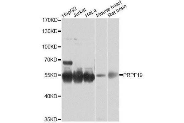 PRP19 anticorps  (AA 127-416)