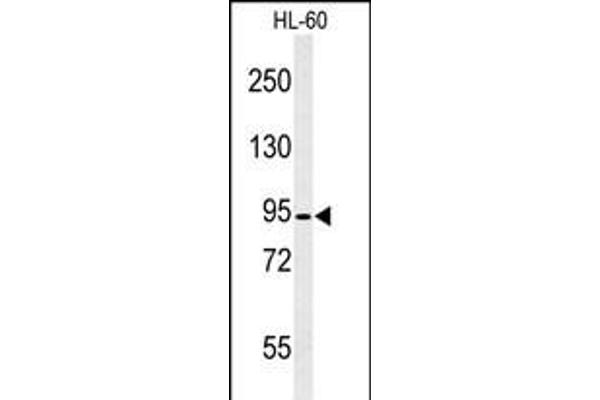 Calpain 3 抗体  (C-Term)