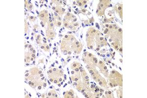 Immunohistochemistry of paraffin-embedded human gastric using CHEK1 antibody. (CHEK1 抗体)
