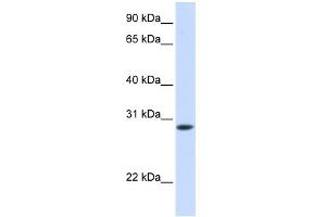 WB Suggested Anti-TNNT3 Antibody Titration:  0. (TNNT3 抗体  (C-Term))