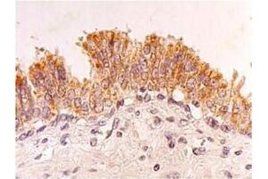 Immunohistochemistry (IHC) image for anti-Four and A Half LIM Domains 2 (FHL2) antibody (ABIN487469) (FHL2 抗体)