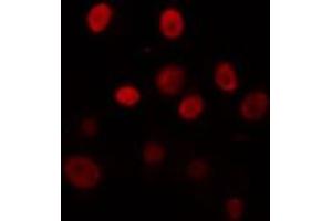 ABIN6274325 staining Hela cells by IF/ICC. (TEF 抗体  (Internal Region))