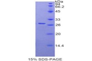 SDS-PAGE (SDS) image for Transmembrane Protease, serine 2 (TMPRSS2) (AA 284-492) protein (His tag) (ABIN2127069) (TMPRSS2 Protein (AA 284-492) (His tag))
