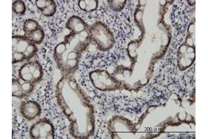 Image no. 2 for anti-Checkpoint with Forkhead and Ring Finger Domains (CHFR) (AA 1-653) antibody (ABIN599268) (CHFR 抗体  (AA 1-653))