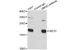 Immunoprecipitation analysis of 150ug extracts of SW620 cells using 3ug UBE2C antibody.
