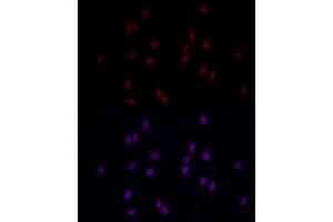 Immunofluorescence (IF) image for anti-Methyltransferase Like 14 (METTL14) (AA 1-210) antibody (ABIN6143759)