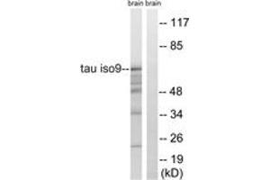 Western blot analysis of extracts from rat brain, using Tau (Ab-717/400) Antibody. (tau 抗体  (AA 366-415))