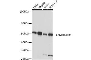 Western blot analysis of extracts of various cell lines, using CaMKII delta Rabbit mAb (ABIN7266019) at 1:1000 dilution. (CAMK2D 抗体)