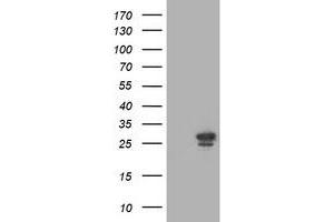 Western Blotting (WB) image for anti-phosphoglycerate Mutase 2 (Muscle) (PGAM2) antibody (ABIN1500169) (PGAM2 抗体)