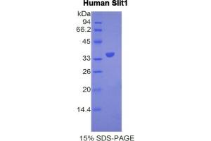 SDS-PAGE (SDS) image for Slit Homolog 1 (SLIT1) ELISA Kit (ABIN6730917)