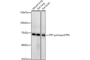 Western blot analysis of extracts of various cell lines, using CTP synthase/CTPS antibody (ABIN7266536) at 1:500 dilution. (CTP Synthase 抗体)