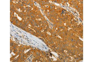 Immunohistochemistry (IHC) image for anti-USO1 Homolog, Vesicle Docking Protein (USO1) antibody (ABIN1875291) (USO1 抗体)