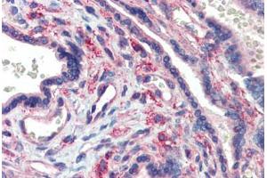 Human Placenta (formalin-fixed, paraffin-embedded) stained with LIN28 antibody ABIN462196 followed by biotinylated goat anti-rabbit IgG secondary antibody ABIN481713, alkaline phosphatase-streptavidin and chromogen. (LIN28A 抗体  (N-Term))