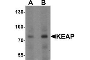 Western blot analysis of KEAP1 in human lung tissue lysate with KEAP1 Antibody  at (A) 1 and (B) 2 μg/ml. (KEAP1 抗体  (C-Term))