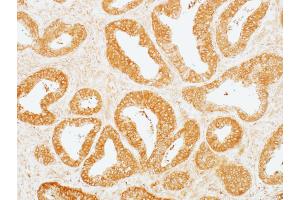 Immunohistochemistry (IHC) image for anti-Mitogen-Activated Protein Kinase Kinase 2 (MAP2K2) (AA 1-50) antibody (ABIN7454013) (Recombinant MEK2 抗体  (AA 1-50))