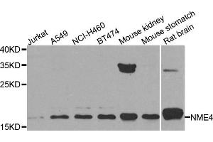 Western blot analysis of extracts of various cell lines, using NME4 antibody. (NME4 抗体)