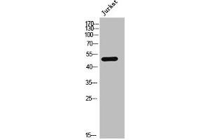 Western Blot analysis of JK cells using AR-α1A Polyclonal Antibody (alpha 1 Adrenergic Receptor 抗体  (Internal Region))