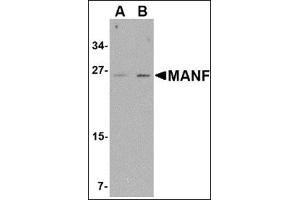 Western blot analysis of MANF in mouse brain tissue lysate with this product at (A) 1 and (B) 2 μg/ml. (MANF 抗体  (C-Term))