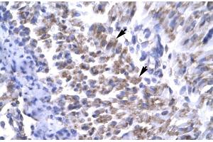 Immunohistochemistry (IHC) image for anti-Excision Repair Cross-Complementing Rodent Repair Deficiency, Complementation Group 8 (ERCC8) (C-Term) antibody (ABIN2777347)