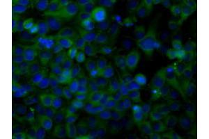 Image no. 2 for anti-Sorting Nexin 9 (SNX9) antibody (ABIN1501045) (SNX9 抗体)