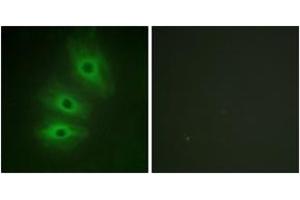 Immunofluorescence analysis of HeLa cells, using ADCY5/6 Antibody. (ADCY5/6 抗体  (AA 931-980))