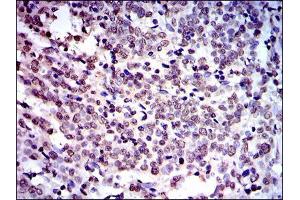 Immunohistochemistry (IHC) image for anti-Neural Precursor Cell Expressed, Developmentally Down-Regulated 8 (NEDD8) antibody (ABIN969546)