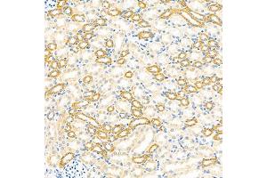 Immunohistochemistry analysis of paraffin-embedded mouse kidney using GBA (ABIN7074062) at dilution of 1: 2000 (GBA 抗体)