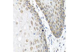 Immunohistochemistry of paraffin-embedded human esophagus using  antibody (ABIN6127432, ABIN6136873, ABIN6136875 and ABIN6223859) at dilution of 1:100 (40x lens). (Angiopoietin 1 抗体  (AA 260-400))