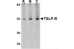 Image no. 1 for anti-Cytokine Receptor-Like Factor 2 (CRLF2) (Center) antibody (ABIN302657) (CRLF2 抗体  (Center))